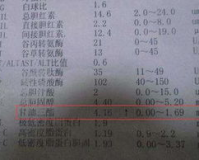 甘油三酯查血清是1.80,建议:如何查血清:甘油三酯保持健康，预防心血管疾病?1.80