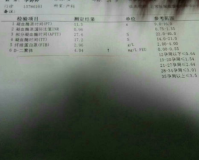 孕29周二聚体1.85,建议:怀孕29周2聚1.85，警惕妊娠期高凝状态!