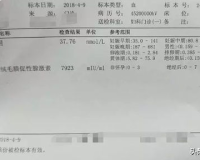 孕酮1.80是什么意思,孕酮1.80通常意味着已经流产