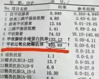 甲状腺抗体1.85