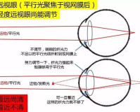 1.85视力:超越清晰，触摸真实