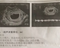 孕囊1.951.85,孕囊1.95x1.85，准妈妈们如何科学解读这本“生命之书”?