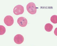 网织红细胞1.85,网织红血球是尚未完全成熟的红血球，其数值的变化反映骨髓红血球的生成情况