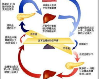 胰岛素1.85，告别高血糖的秘密武器！