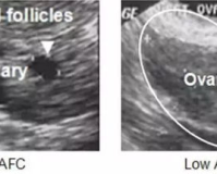 卵泡1.85内膜1.4：女性的生育能力和健康状况