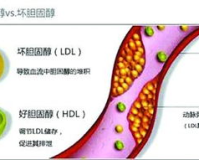 胆固醇1.85要紧吗,胆固醇1.85不要紧吗?媒体专家来分析健康指数。