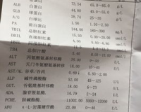 谷草谷丙1.85严重吗,谷草谷丙1.85是否严重，要根据具体情况来判断。