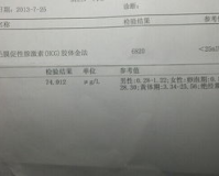 孕酮1.85hcg33.5,建议:1.85hcg33.5疑似怀孕会遭遇“失落之痛”吗?