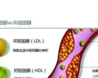 低密脂胆固醇1.85：如何保持健康的胆固醇水平