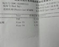 孕晚期甘油三酯1.85